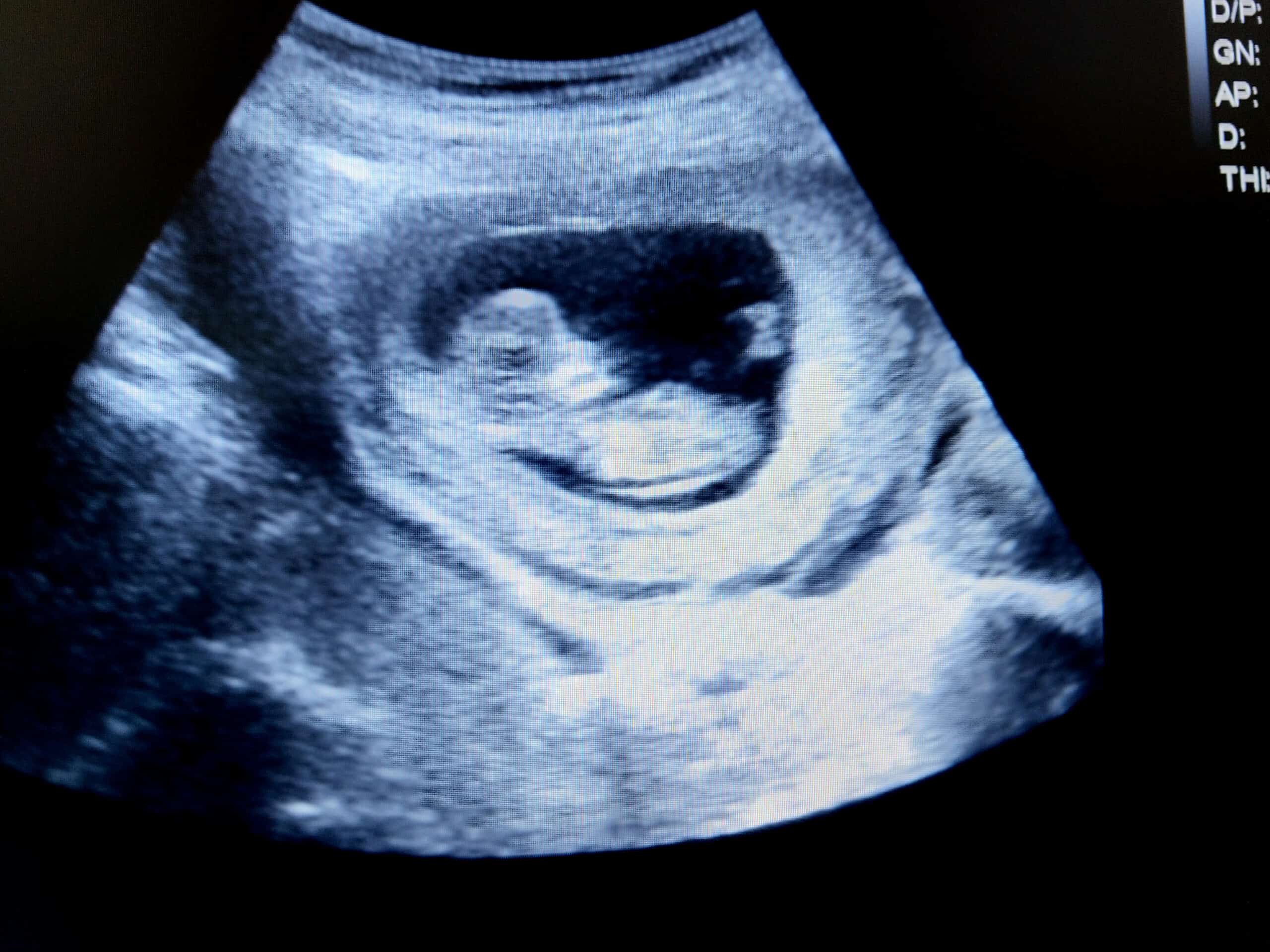 Weeks Pregnant | Pregnancy | MomsWhoThink.com