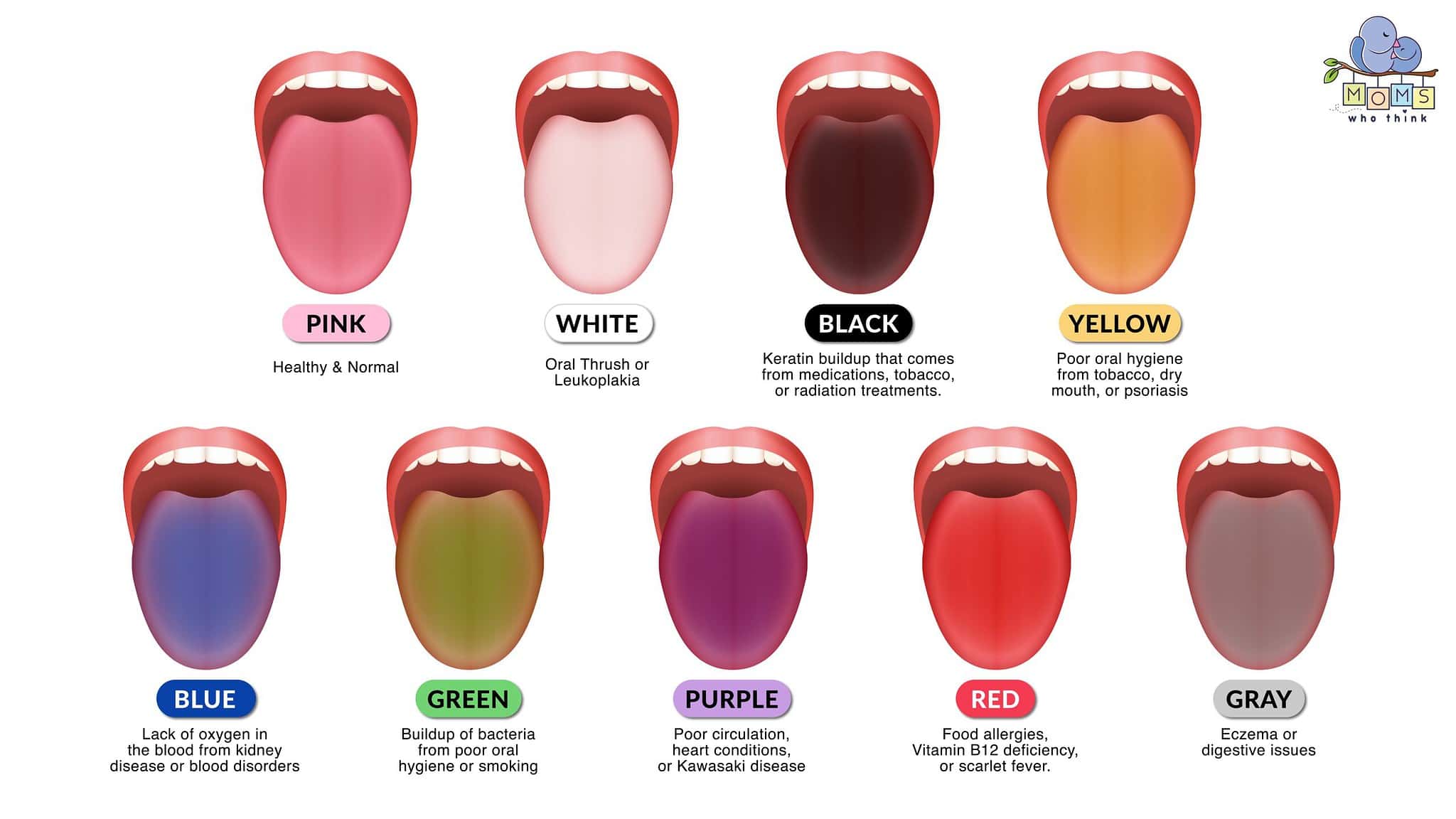 use-this-tongue-color-chart-to-understand-your-health