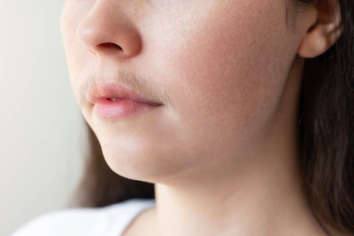 A close-up of a woman's face with a mustache over her upper lip. The concept of hair removal and epilation. Pregnancy symptoms no one warns you about