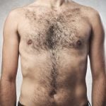 A Lot of Body Hair