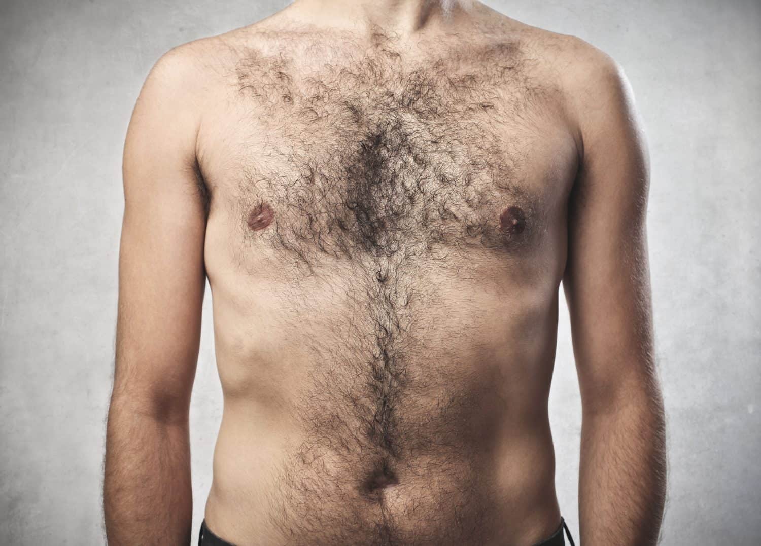 A Lot of Body Hair