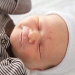 Most Newborns Have a Birthmark